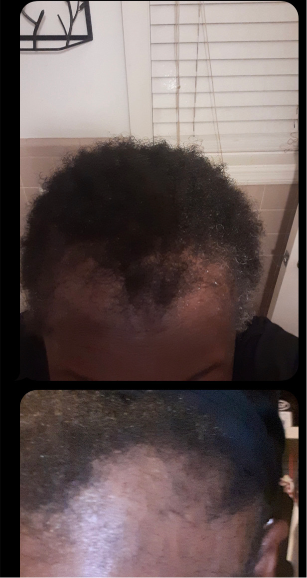 Hair Growth Oil