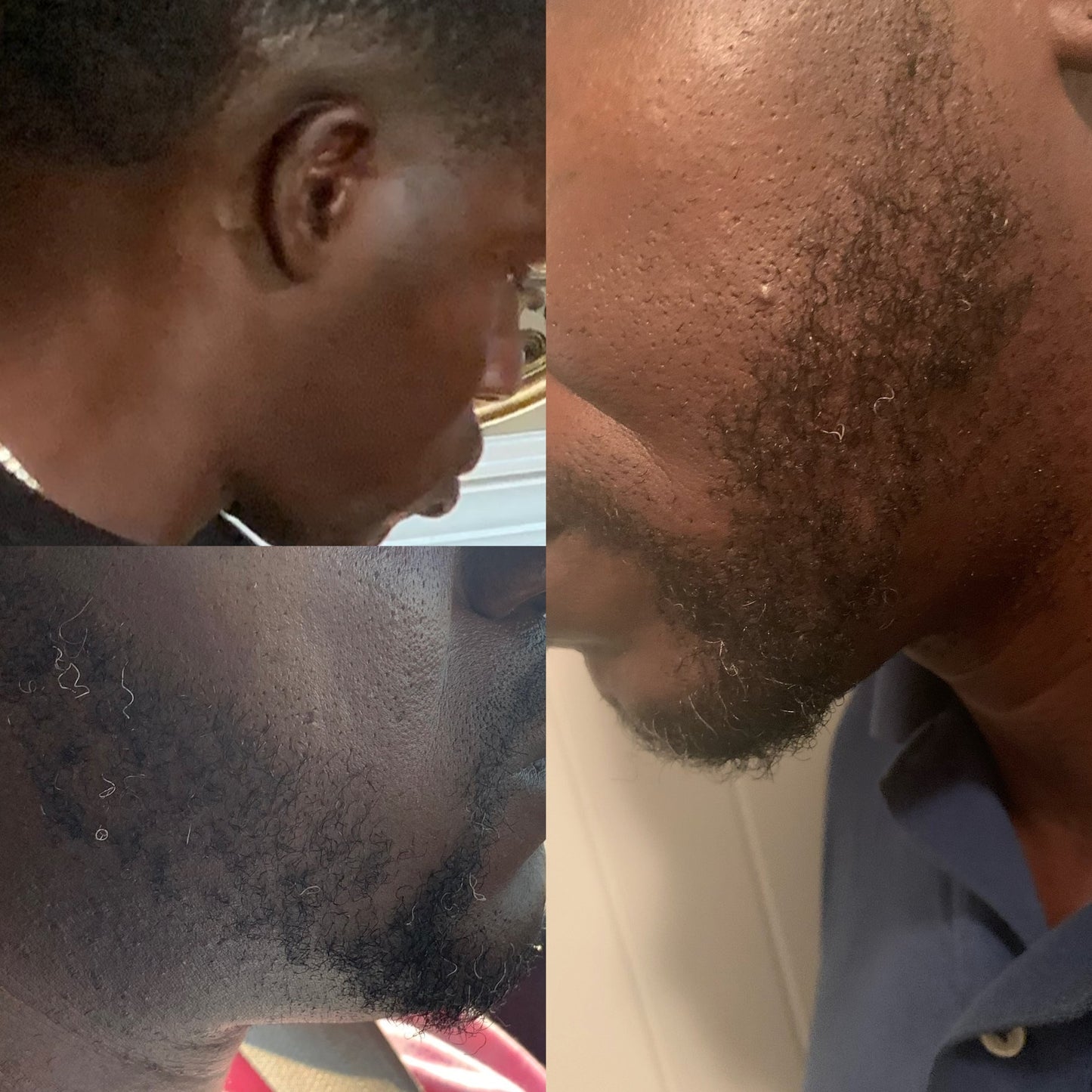 Hair Growth Oil